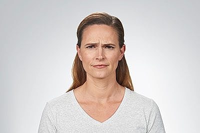 Cheek Fillerzz Before & After